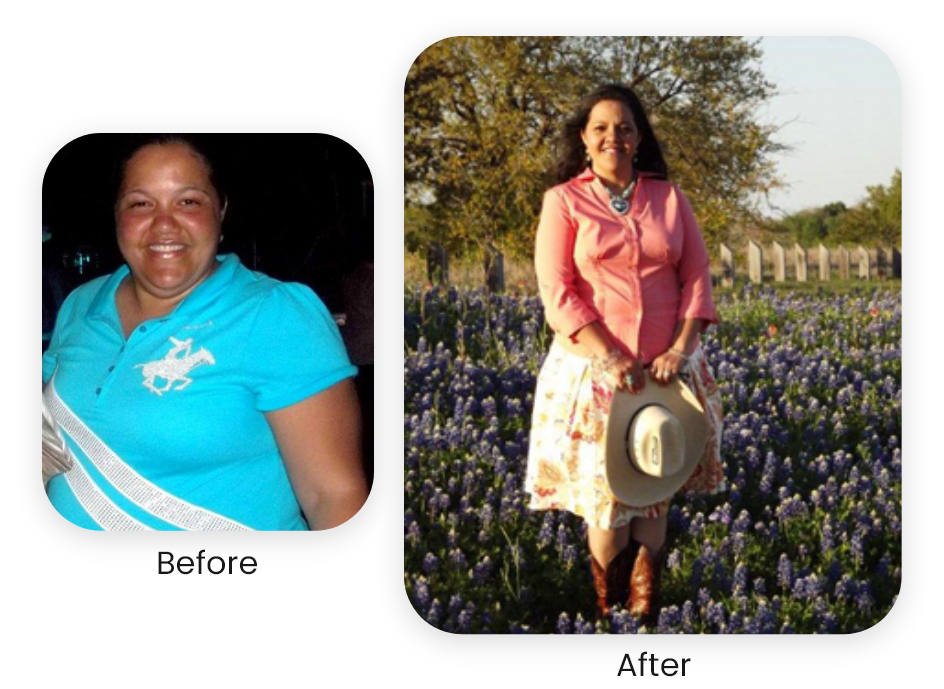 Lourdes — actual NuSelf patient — Antes y después · Los resultados varían.