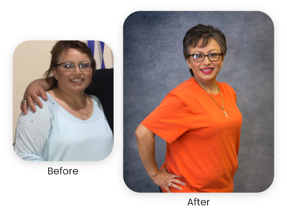Susan — actual NuSelf patient — Antes y después · Los resultados varían.